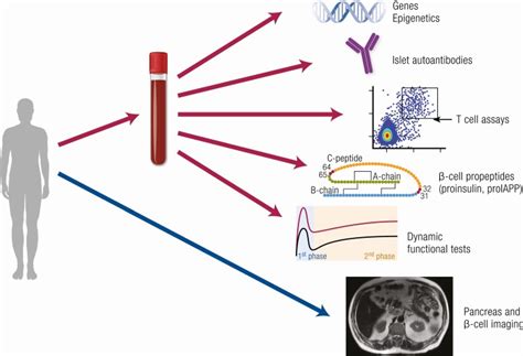 β Cell in Diabetes: Integrating Biomarkers With Functional .
